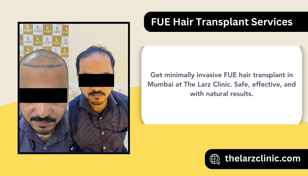 fue-hair-transplant-mira-road-mumbai